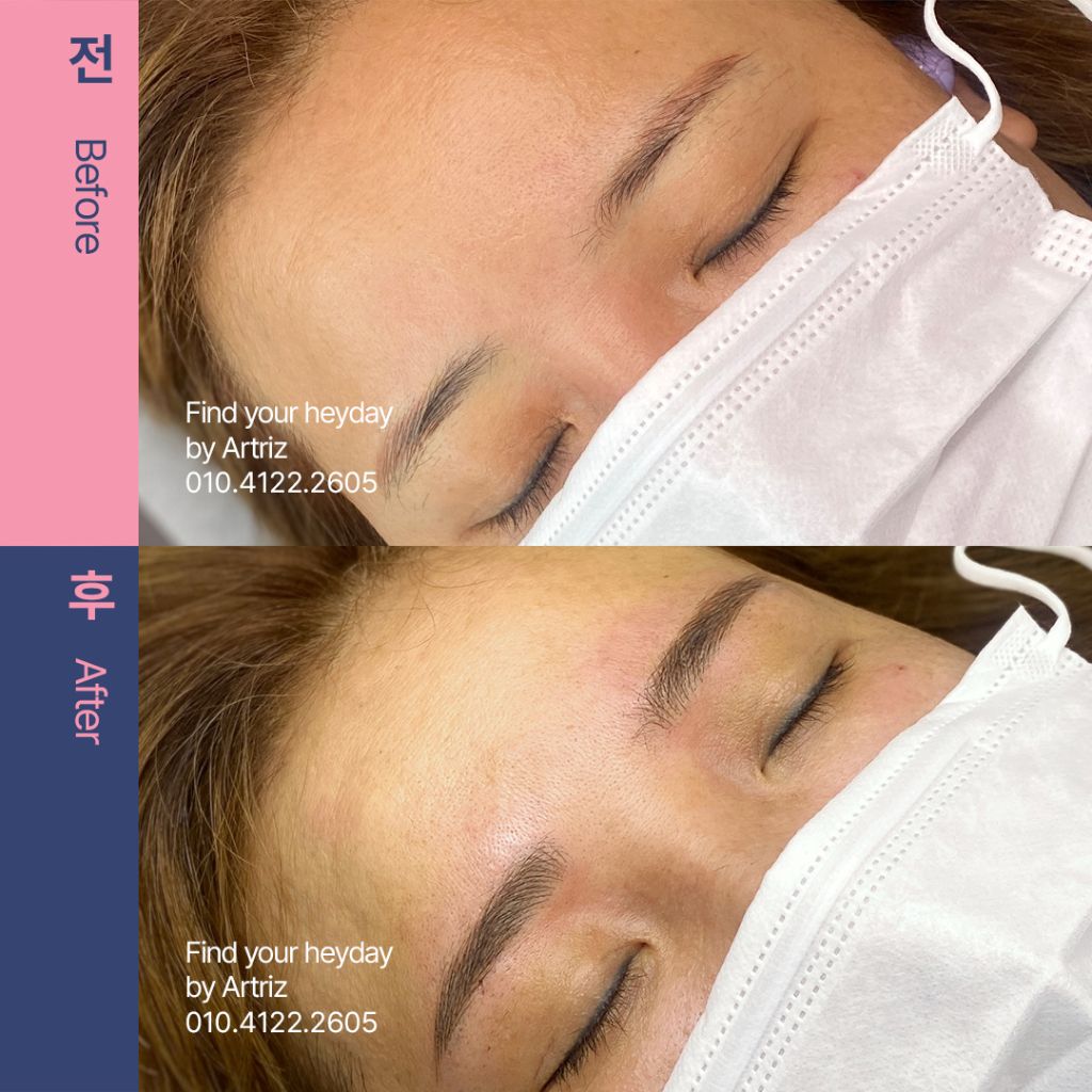 눈썹문신 before after