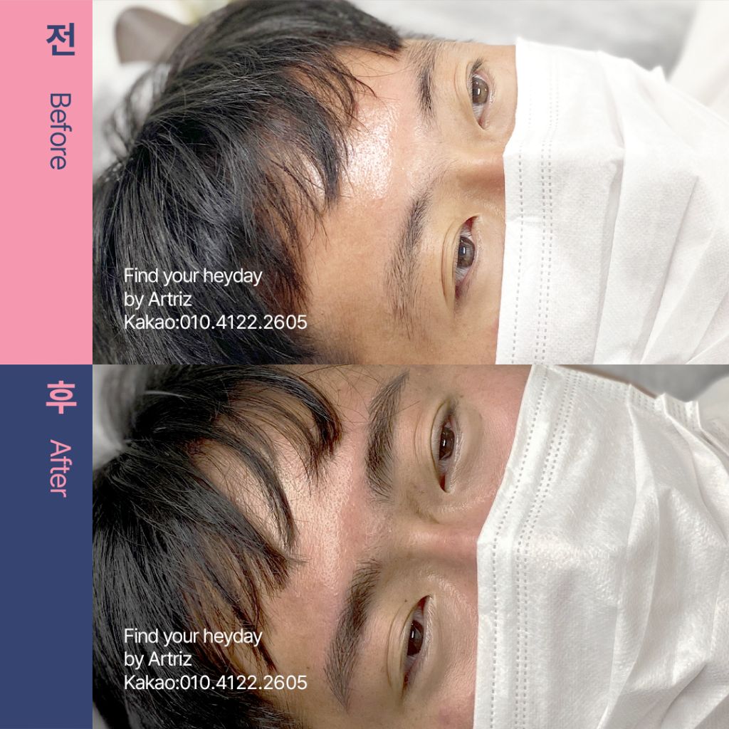 눈썹문신 before after