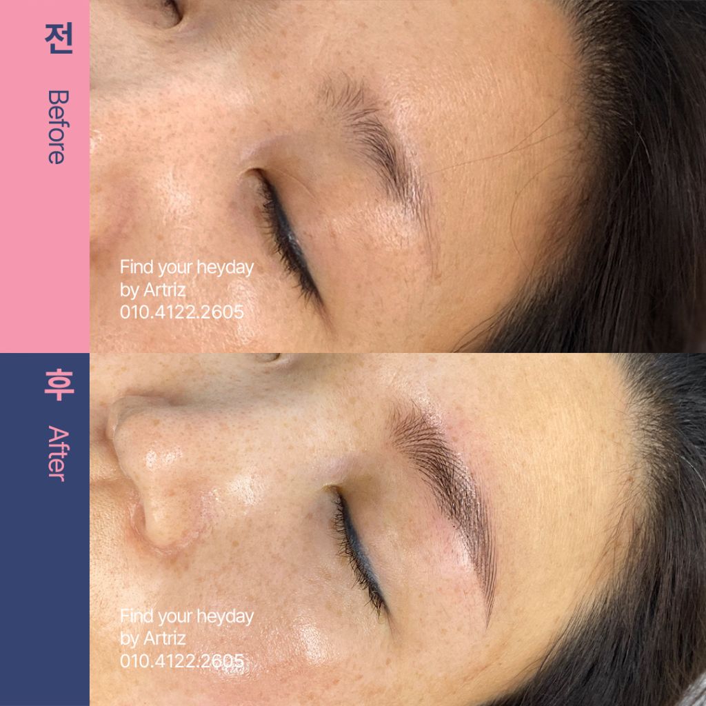 눈썹문신 before after