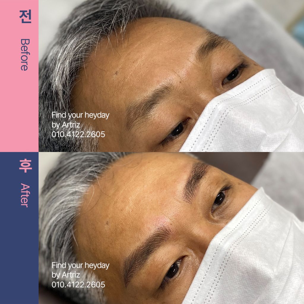 눈썹문신 before after